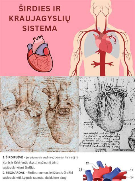 infografika_siltinimo_sistemos