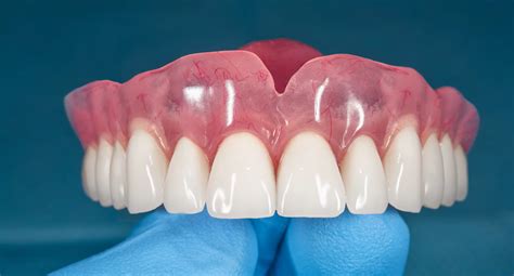 Laikini dantų protezai