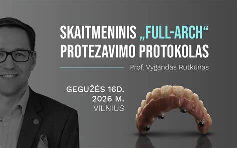 Infografika: silikoninių atspaudų procesas ir skaitmeninis skenavimas