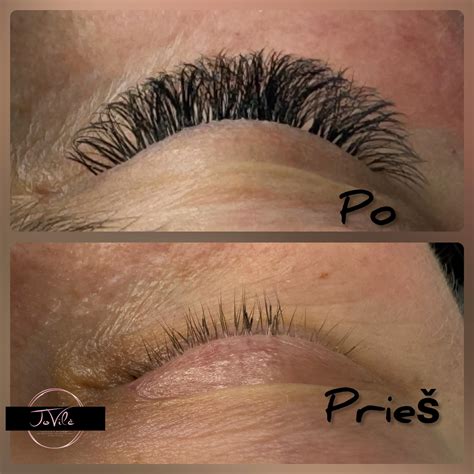 Traiškanotos, sulipusios blakstienos