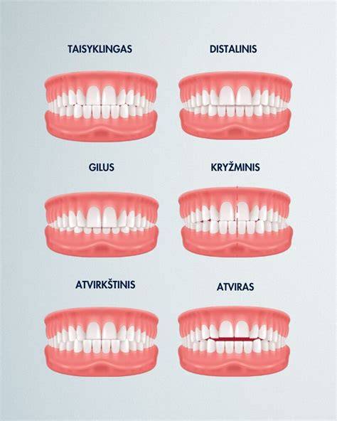 Briaunų tipai lentelėje