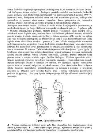 Gruntavimo ir klijavimo kompleksas - operacijos schema
