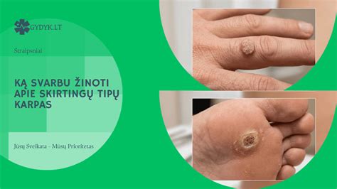 Infografika: skirtingų sienų klojinio tipų palyginimas