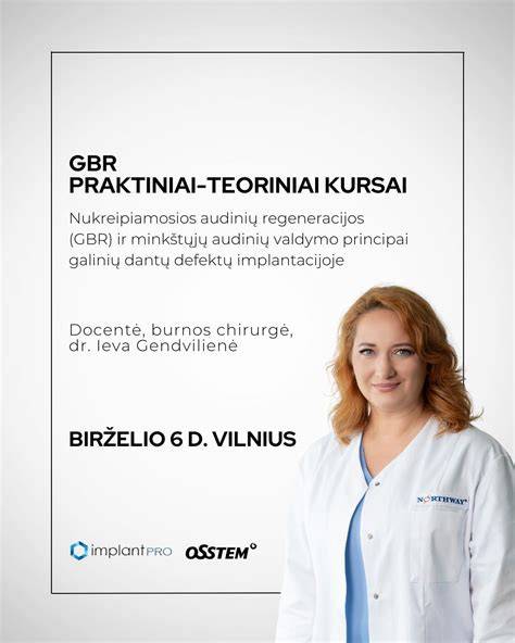 Infografika: stovo tipų palyginimas, jų tinkamumas skirtingoms erdvėms