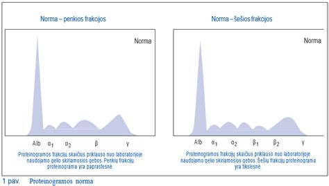Scheminis baltymų frakcijų pasiskirstymas kraujo serume