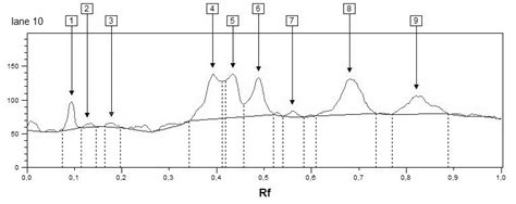 Grafinis proteinogramos vaizdas (densitograma)