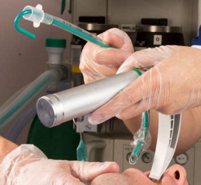 Infografika: Endotrachėjinis intubacijos procesas