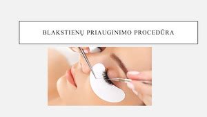 Blakstienų priauginimo procedūra