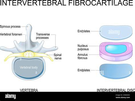 fibros armavimo principo schema