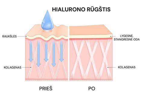 Infografika: kaip veikia hialurono rūgštis odoje
