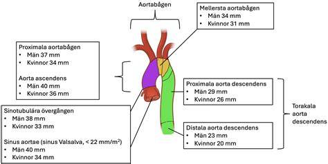 Aorta descendens ir pagrindinės šakos