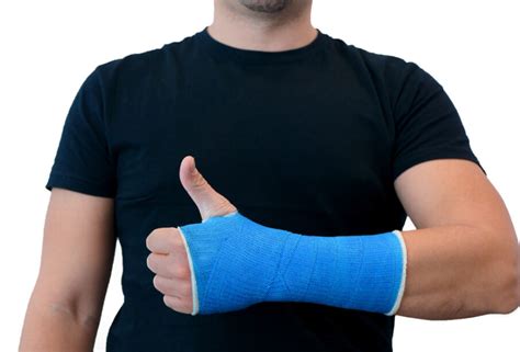 Gipso įtvarų charakteristikos vaizdas: skirtingų tipų įtvarai
