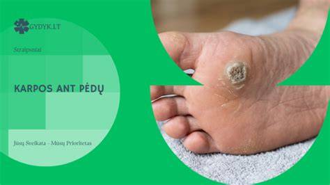 Karpos diagnozės ir gydymo vizualizacija: tipų išsidėstymas ant kūno