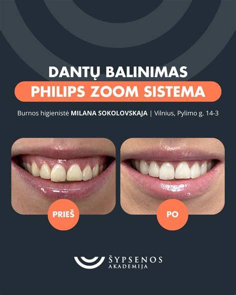 Balinimo efektas ant seno ir naujo medienos paviršiaus prieš ir po