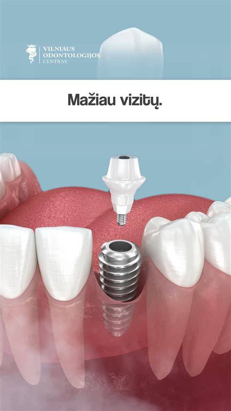 Siūlių glaistymo procesas vizualiai aiškinantis etapų sekančias pakopas