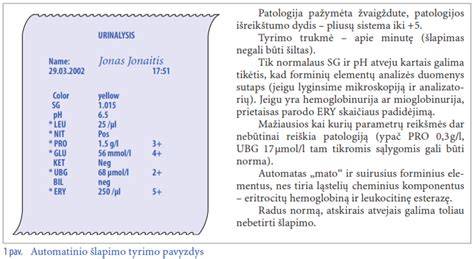 Infografika: Šlapimo tyrimo proceso aptarimas, juostelinė analizė vs. mikroskopija
