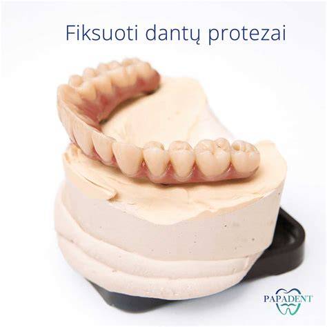 Žingsniai implantato protezavimo procese: planavimas, atspaudai, laikini protezai
