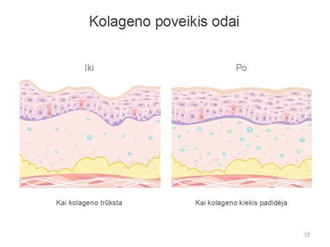 Infografika: impregnavimo tipai ir jų poveikis medienai