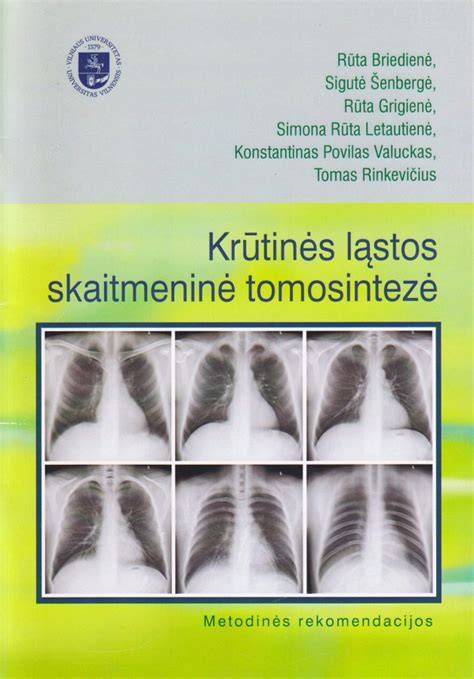 Krūtinės ląstos stuburo suliejimo tipų palyginimas