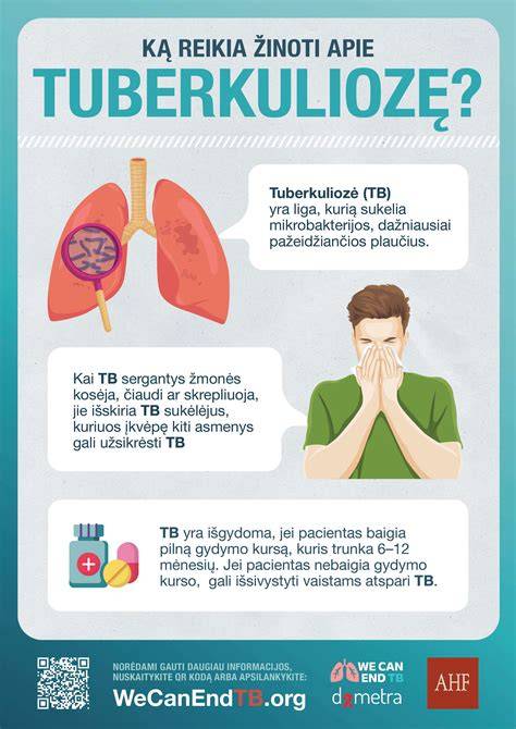 Infografika: ką reikia žinoti apie kompensacines juostas
