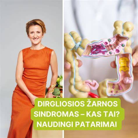 Infografika: žarnos parinkimo patarimai