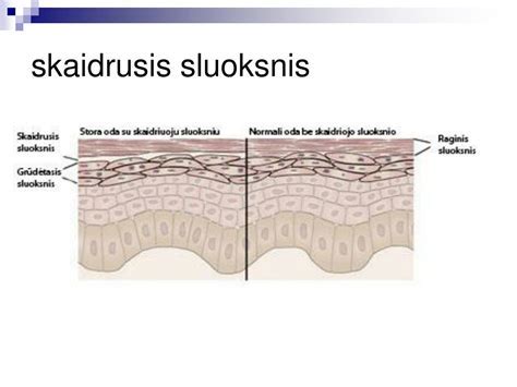 Grafinė schema: impregnavimo procesas ir sluoksnių skaičius