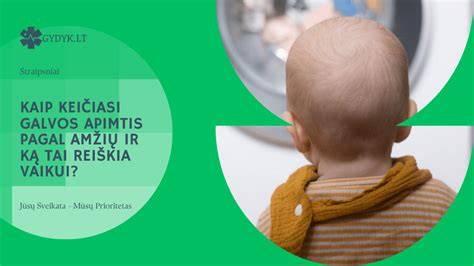 Logo: Grupinis Pirkimas - ką reiškia ir kaip veikia