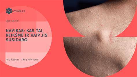 Infografika: kaip susidaro privalomieji atskaitymai 5%
