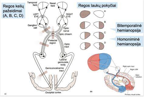 Diagram: pasirinkimo kelių scenarijai pagal patalpų tipą