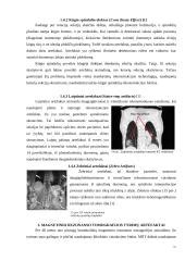 Infografika: malkų rūšys ir drėgmės įtaka degimui