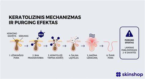 Infografika: Impregnavimo mechanizmas ir nauda