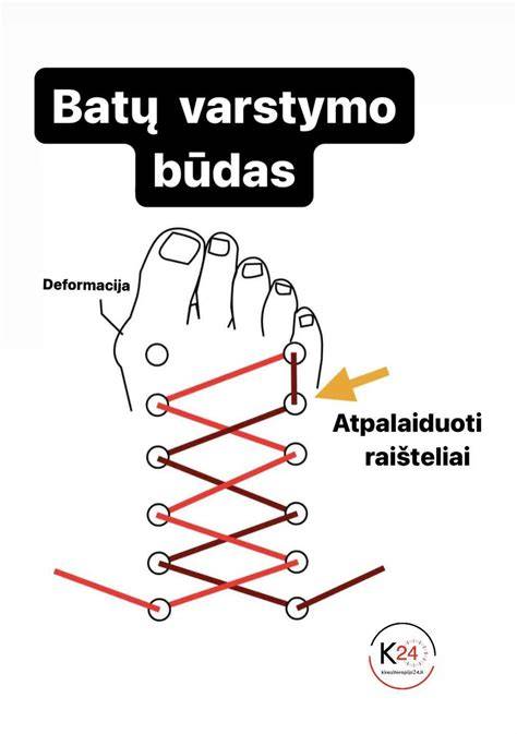 Būdas palengvinti rąstų keitimą - kabės, pleištai, hidroizoliacija