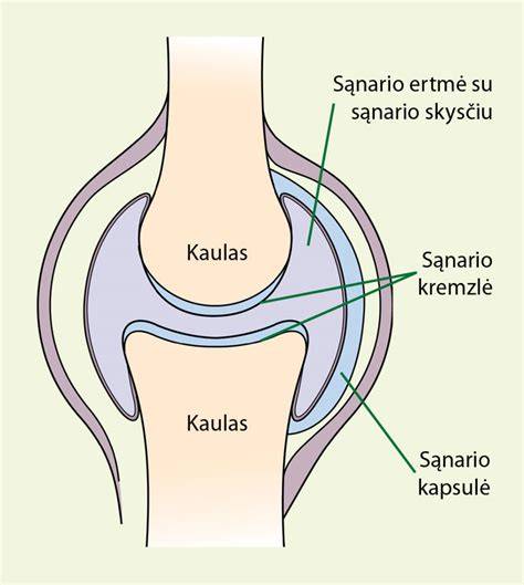Infografika: Čiurnos sąnario struktūra ir įtvarų tipai