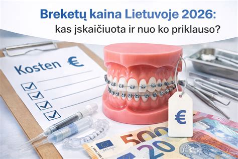 Infografika: vinilo kaina priklausomai nuo retumo