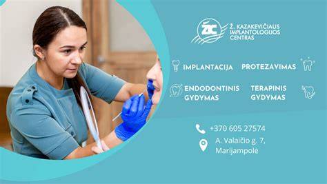 Infografika: Poliuretaninių klijų palyginimas pagal pagrindą, elastingumą ir naudojimo sritis