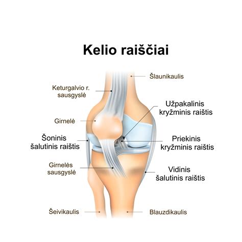 Rankos įtvarų ir gipso raiščio pritaikymas - schema