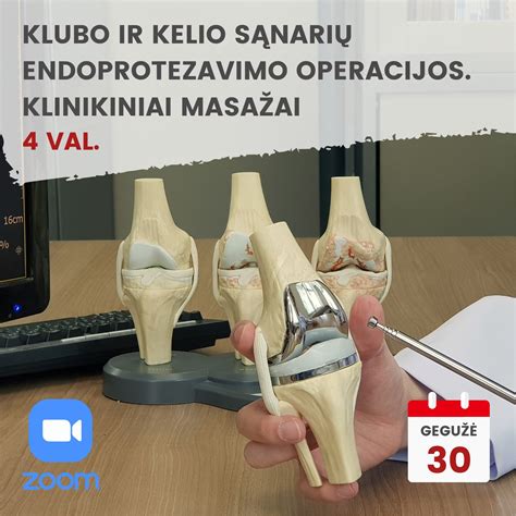 Infografika: klubo sąnario anatomija ir uždegimo mechanizmai