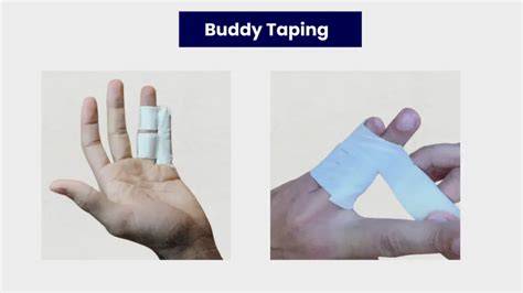 Infografika: Buddy taping proceso žingsniai